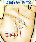 運命線が断線する