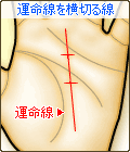 運命線に横切る線がある