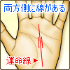 運命線の両方側に線がある
