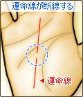 運命線が断線する