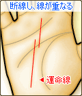 運命線が断線して、線が重なる