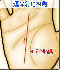 運命線に四角(スクエア)がある