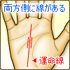 運命線の両方側に線がある
