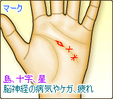 知能線上や付近のマーク