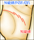 知能線が切れ切れ