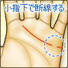 感情線が小指の下あたりで断線する