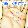 感情線が薬指の下あたりで断線する