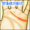 感情線の鎖状