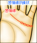 感情線が鎖状
