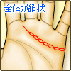 感情線全体が鎖状