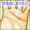 感情線に島(アイランド)がある