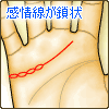 感情線の鎖状