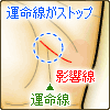 運命線が影響線で止まる