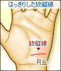 はっきりした放縦線