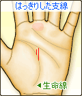 はっきりした線