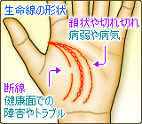 生命線の形状