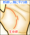 生命線が断線し、隣に平行な線(姉妹線)がある