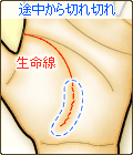 生命線の途中から切れ切れ