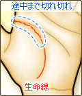 生命線の途中まで切れ切れ