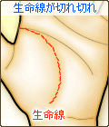 切れ切れの生命線