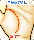 生命線が鎖状
