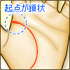 生命線の起点が鎖状