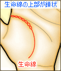 生命線の上部分が鎖状