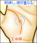 断線した生命線が重なる