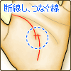 断線した生命線が重なり、互いをつなぐ線がある