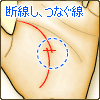 断線した生命線が重なり、互いをつなぐ線がある