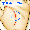 生命線上に島(アイランド)がある