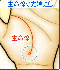 生命線の先端に島がある