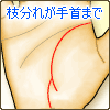 枝分れした線が手首まで伸びる