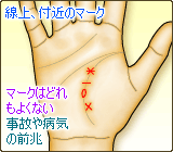 生命線上、付近のマーク