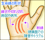 生命線の形状