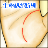 生命線が断線する