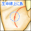 生命線上に島(アイランド)がある