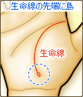 生命線の先端に島がある