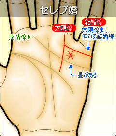 セレブ婚