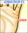 結婚線が断線する