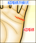 結婚線が鎖状