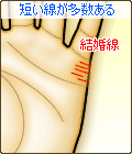 短い結婚線が多数ある