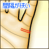 結婚線の間隔が狭い