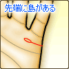 結婚線の先端に島(アイランド)がある