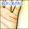 結婚線の始点に島(アイランド)がある
