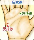 反抗線