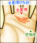 金星環が多数ある