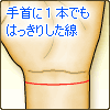 手首に1本でもはっきりした線
