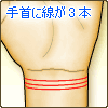手首に線が3本ある
