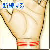 手首上にある線が断線する